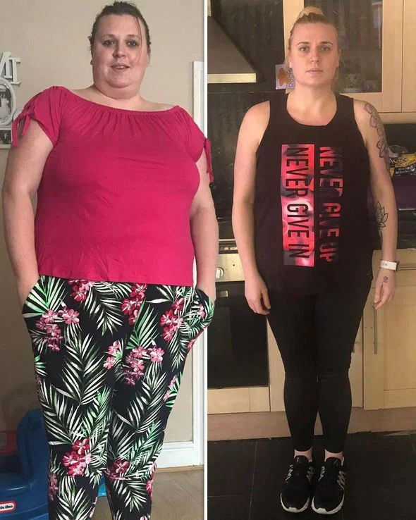 Antes e depois — Juliana, 41 anos